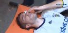 Τρομακτικός τραυματισμός του Φαν Πέρσι στο μάτι