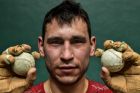 In this Tuesday, March 5, 2019 photo, Diego Iturriaga, 27, a player of Basque Ball known as "pelotari", holds Basque Balls as he poses for a photo at Labrit court or fronton, in Pamplona, northern Spain. With their hands protected by layers of tightly-bound tape, the players take turns swatting a small, hard ball at speeds that reach 115 kilometers (71.4 miles) per hour. (AP Photo/Alvaro Barrientos)