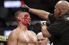 Το πρόσωπο του Νέιτ Ντίαζ ήταν σε πολή κακή κατάσταση, ήδη από τον 1ο γύρο του αγώνα απέναντι στον Χόρχε Μάζβινταλ για το UFC 244, Νέα Υόρκη, Κυριακή 3 Νοεμβρίου 2019