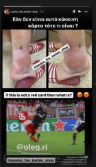 Ο κομμωτής του Ρέαμπτσουκ φωτογράφισε το πρησμένο πόδι του Μολδαβού από το ματς με την Άιντραχτ