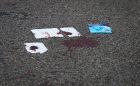 Blood on the road of Westbourne High St, Bournemouth. Its alleged that Harry Rednkapp ran over his wife Sandra. Pic Simon Jones