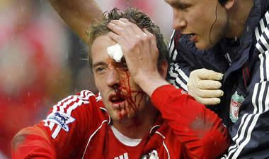 Με σπασμένη μύτη στο ντέρμπι ο Κράουτς