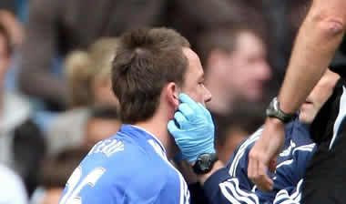 Κάταγμα στο ζυγωματικό υπέστη ο Τέρι