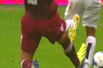 Η σοκαριστική φωτογραφία του ποδιού του Τέβες