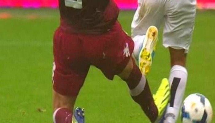 Η σοκαριστική φωτογραφία του ποδιού του Τέβες