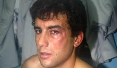 Επεισόδιο Αραούχο-Εστογιανόφ