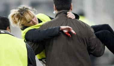 Σεκιούριτι έχασε δύο δάκτυλα από ρίψη κροτίδων