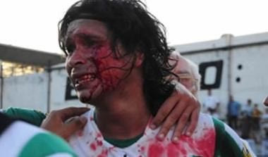 Εν ψυχρώ μπουνιά κατά τη διάρκεια αγώνα (vid)