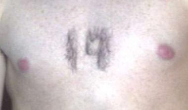 Ποιος ποδοσφαιριστής της Γιουνάιτεντ ξύρισε το στήθος του σχηματίζοντας τον αριθμό 19;