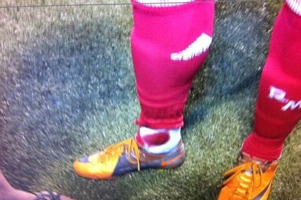 Ο Λέκο μάτωσε τον Ρονάλντο