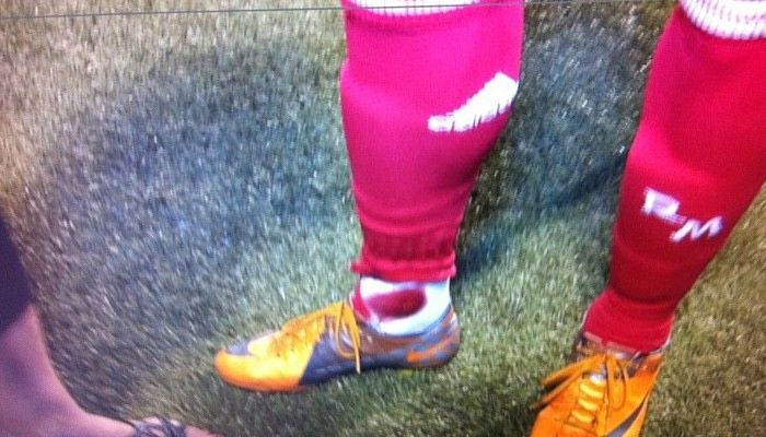 Ο Λέκο μάτωσε τον Ρονάλντο