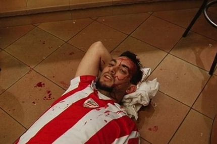 Πανικός και συλλήψεις πριν το Μπιλμπάο-Παρί