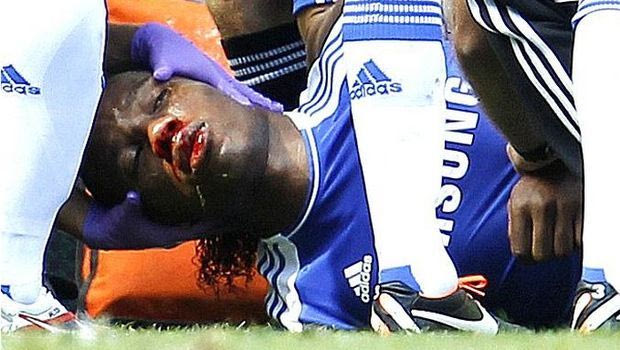 Ντρογμπά: “Τυχερός που ζω”