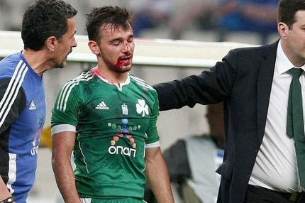 Κάταγμα ο Νίνης