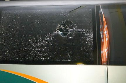 Τελικά, τα θέλει ο… κώλος μας