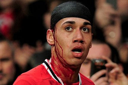 Eκ νέου άτυχος ο Σμόλινγκ