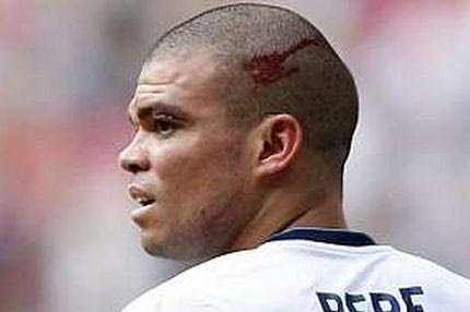 Ενα μήνα έξω ο Πέπε