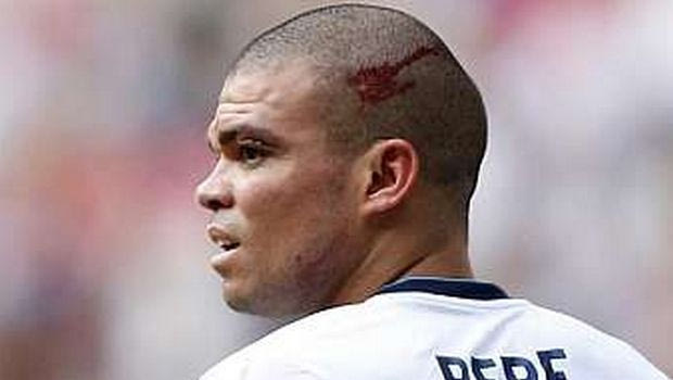 Ενα μήνα έξω ο Πέπε