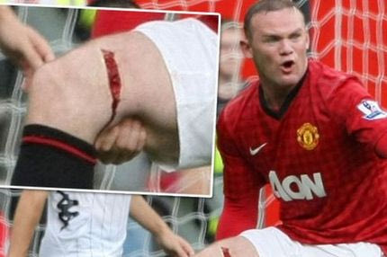 “Έζησε για ένα χιλιοστό ο Ρούνεϊ”