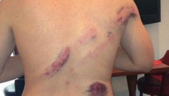 Οι οπαδοί της Μονπελιέ καταγγέλλουν την ΕΛ.ΑΣ