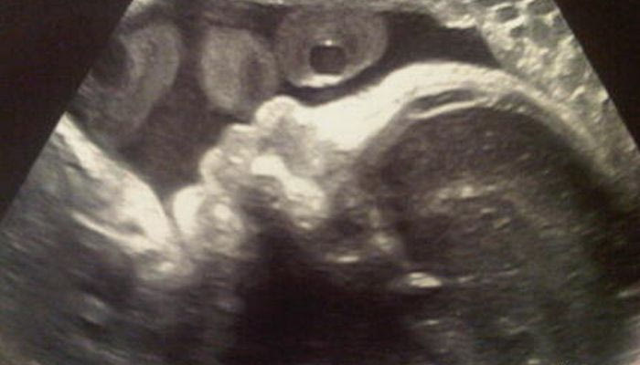 Ο διάδοχος του Πικέ στην κοιλιά της Σακίρα