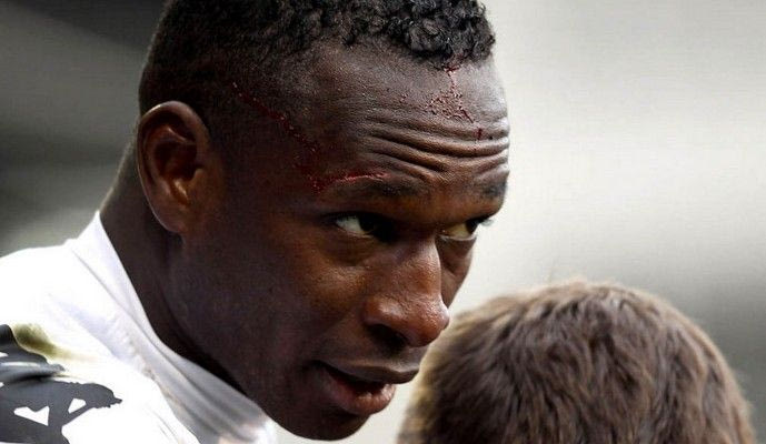 Το ιατρικό τιμ περιμένουν οι “πράσινοι” για να κινηθούν για τον Ντιαρά