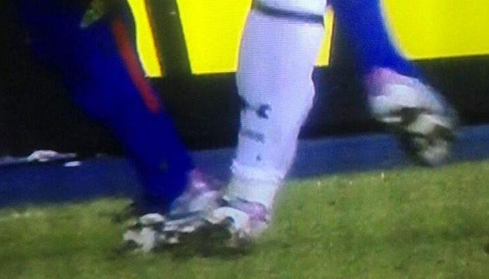 Τραυματισμός σοκ του Μπέιλ