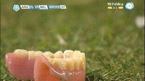 Πέταξε τη μασέλα του στον αγωνιστικό χώρο