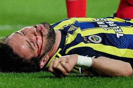 Ο ανατριχιαστικός τραυματισμός του Γιονούλ