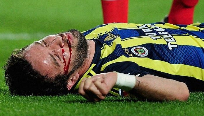 Ο ανατριχιαστικός τραυματισμός του Γιονούλ