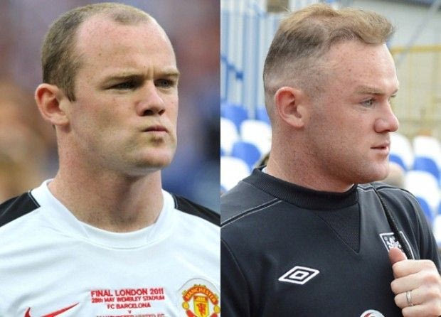 Έβαλε ξανά μαλλιά ο Ρούνεϊ