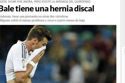 Marca: Κήλη στη μέση ο Μπέιλ!