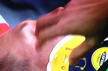 Τραυματίστηκε σοβαρά ο Τιτόν