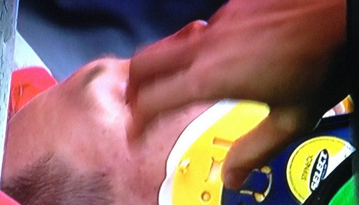 Τραυματίστηκε σοβαρά ο Τιτόν