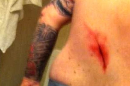 Μαχαιρώθηκαν οπαδοί της Κοπεγχάγης στο Τορίνο