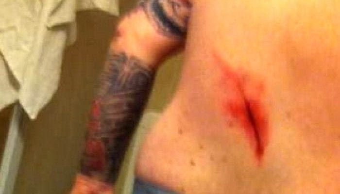 Μαχαιρώθηκαν οπαδοί της Κοπεγχάγης στο Τορίνο