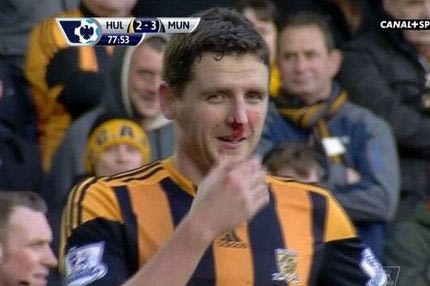 Συγκρούστηκε με το δοκάρι ο Μπρους