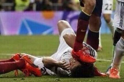 Πάτησε τον Πέπε στο κεφάλι