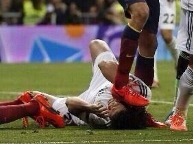 Πάτησε τον Πέπε στο κεφάλι