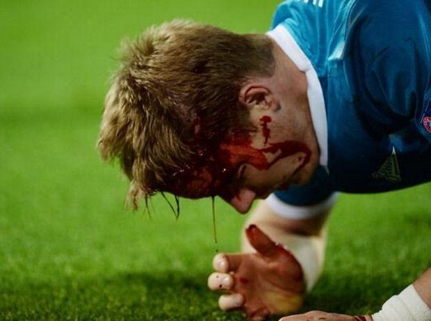 Ο Λεβαντόφσκι άνοιξε το κεφάλι του Χούμποτσαν