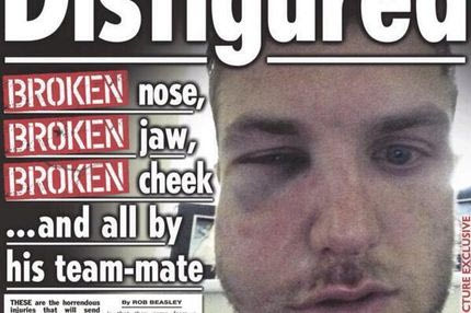 Σακάταψε τον αρχηγό του στο ξύλο και έφυγε