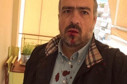 Εισαγγελική δίωξη κατ’ αγνώστων για την επίθεση στον Βετάκη
