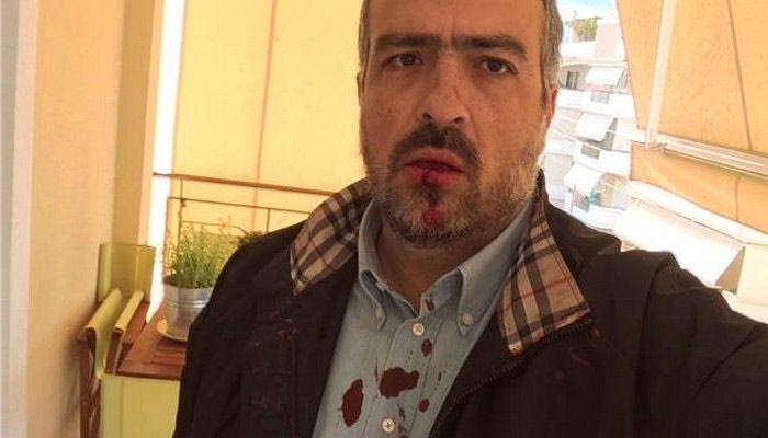 Εισαγγελική δίωξη κατ’ αγνώστων για την επίθεση στον Βετάκη