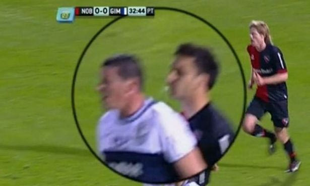 Έφτυσε αντίπαλο ο Σκόκο