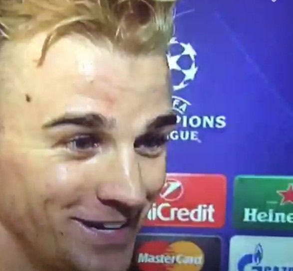 Χαρτ: “Ελπίζω να μην σκόραρε ο Κόουλ!” (VIDEO)