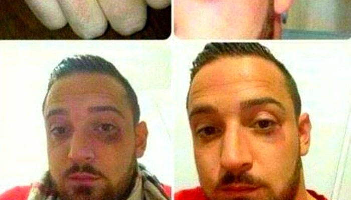 Ποδοσφαιριστής υποστήριξε τους αντάρτες του Κομπάνι και δέχθηκε ρατσιστική επίθεση