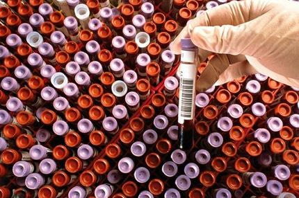 Συμπληρώματα με απαγορευμένες ουσίες. Πάλι!