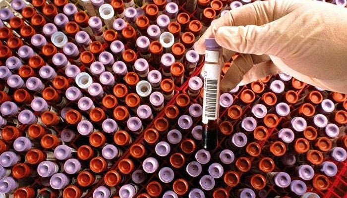 Συμπληρώματα με απαγορευμένες ουσίες. Πάλι!