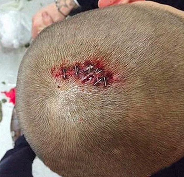 Τα οκτώ ράμματα του Σκρτελ (PHOTO)