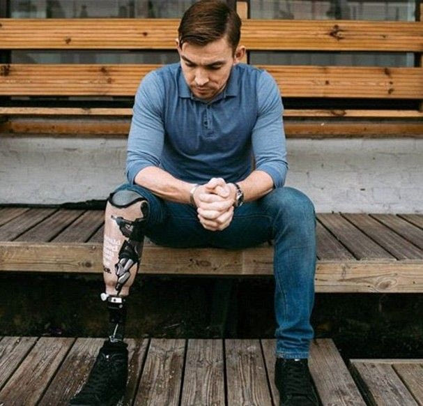 Η συγκλονιστική ιστορία του Άντι Γκραντ: το ακρωτηριασμένο πόδι, το αλλοιωμένο tattoo και η κατάθεση ψυχής (PHOTOS)